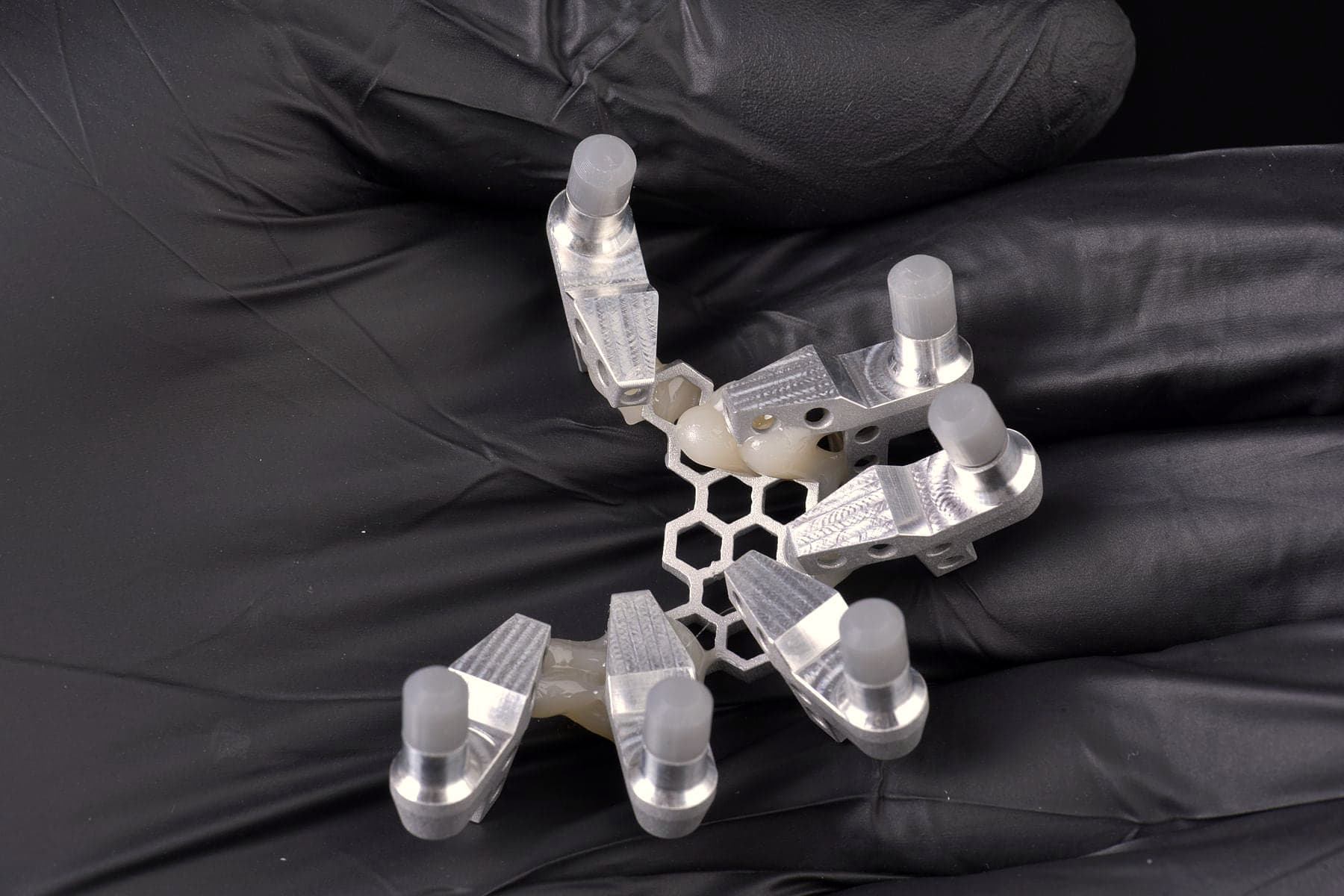 Guide chirurgical utilisé pour poser les implants avec précision